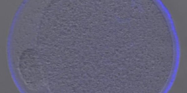 Article teaser image