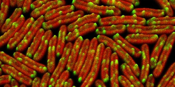 Article teaser image