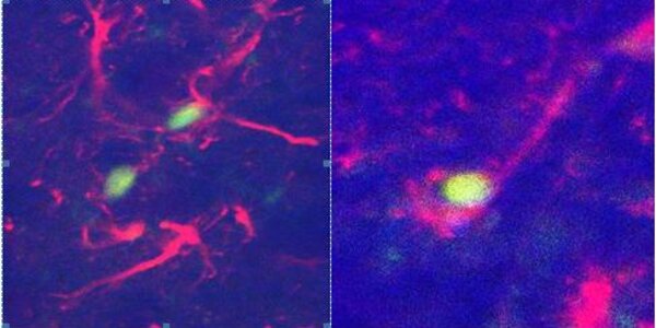 Article teaser image