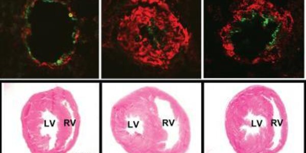 Article teaser image