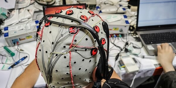 Article teaser image