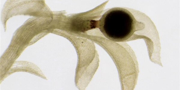 Article teaser image