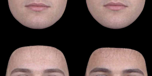 Article teaser image