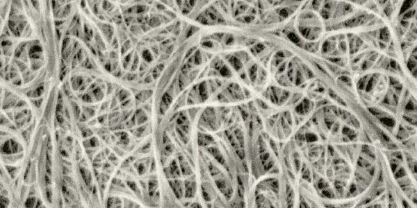 Article teaser image