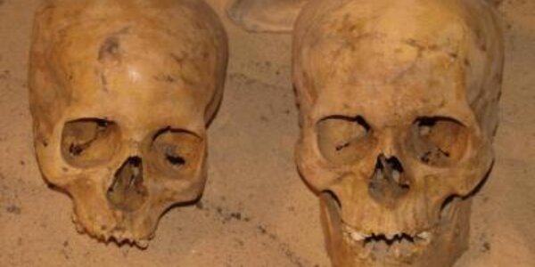 Article teaser image