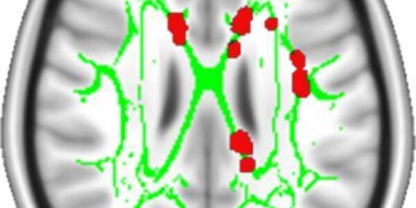 Article teaser image