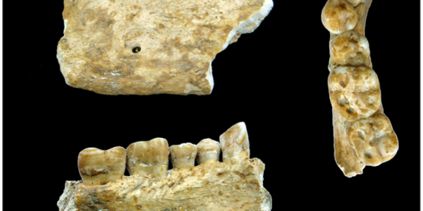 Article teaser image