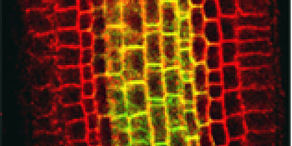 Article teaser image