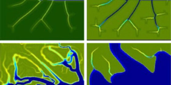 Article teaser image