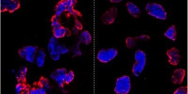 Article teaser image