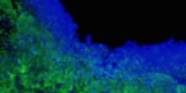 Article teaser image