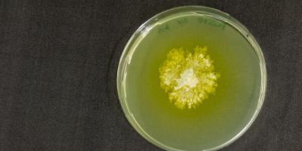 Article teaser image