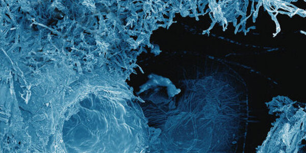 Article teaser image