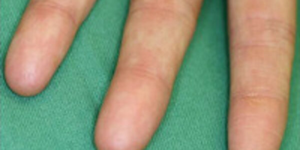 Article teaser image