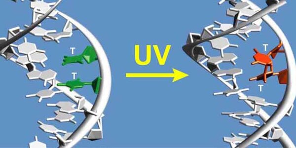 Article teaser image