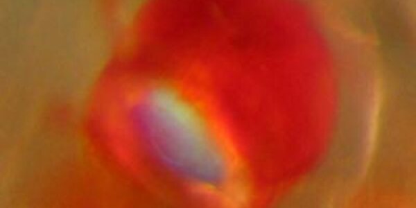 Article teaser image