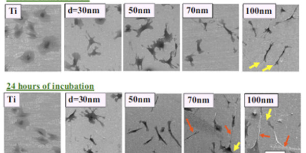 Article teaser image