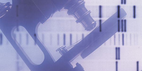 Article teaser image