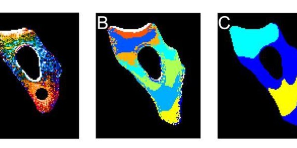 Article teaser image