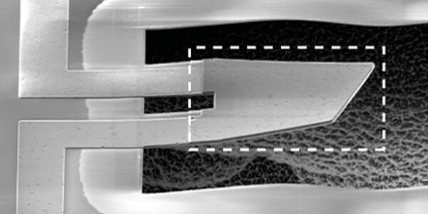 Article teaser image