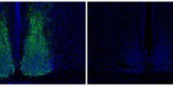 Article teaser image