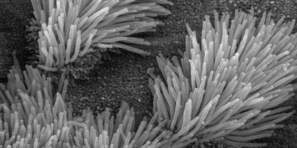 Article teaser image