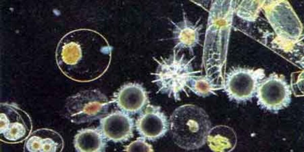 Article teaser image