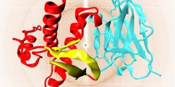 Article teaser image