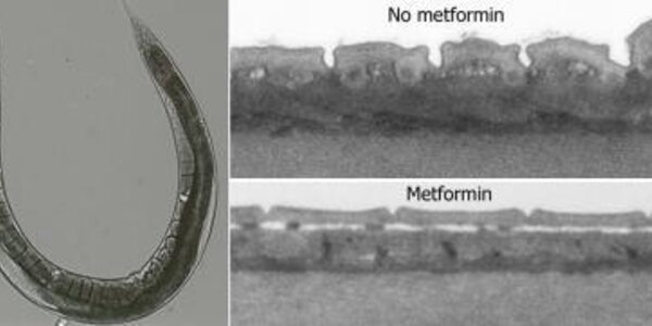 Article teaser image