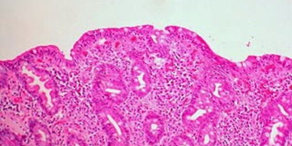 Article teaser image