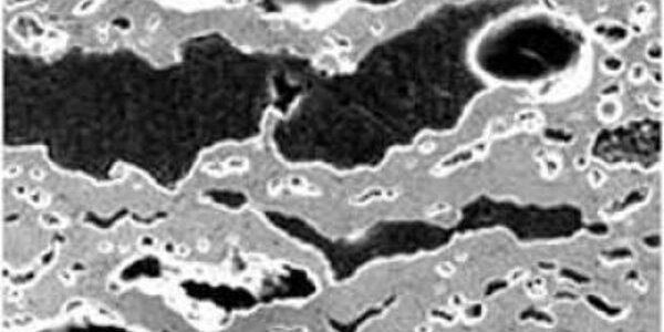 Article teaser image