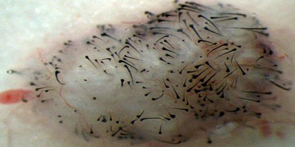 Article teaser image