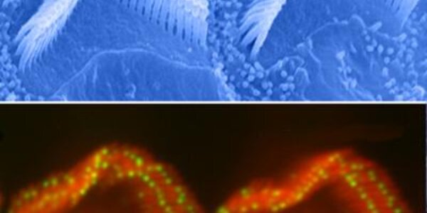 Article teaser image