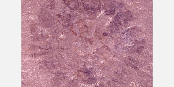 Article teaser image