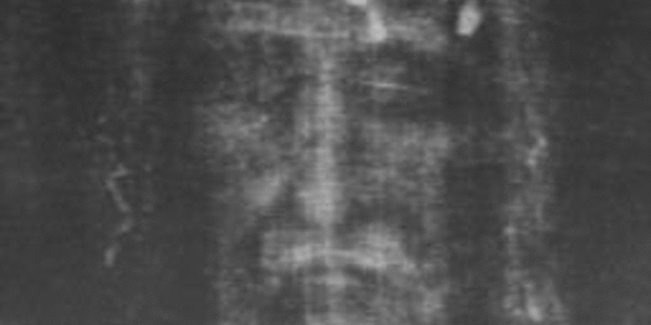 Article teaser image