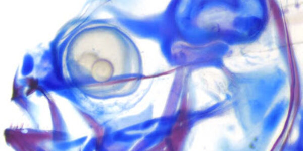 Article teaser image