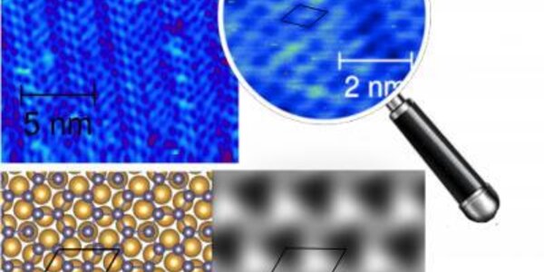 Article teaser image