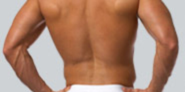 Article teaser image