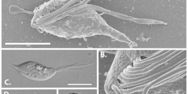 Article teaser image