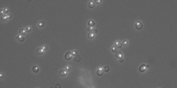 Article teaser image