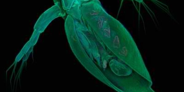 Article teaser image