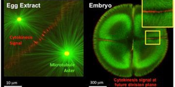 Article teaser image