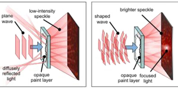 Article teaser image