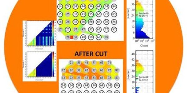 Article teaser image