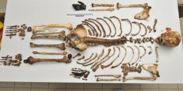 Article teaser image