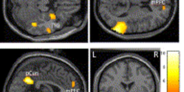 Article teaser image