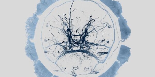 Article teaser image