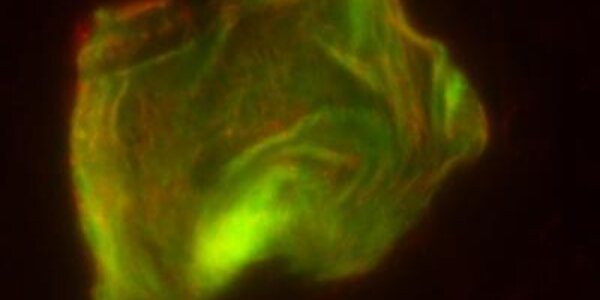 Article teaser image