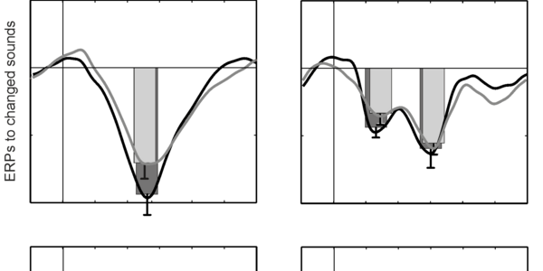 Article teaser image