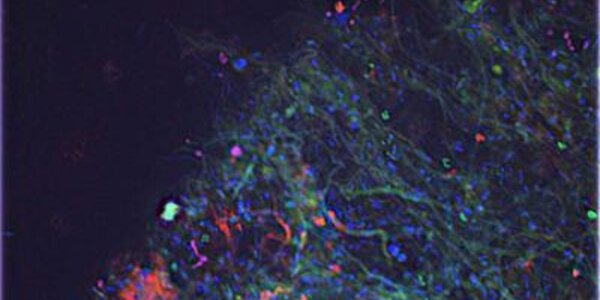 Article teaser image